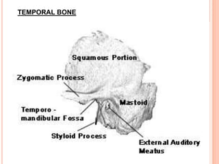 TEMPORAL BONE
 