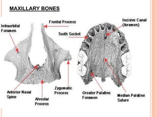 MAXILLARY BONES
29
 