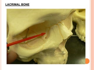 LACRIMAL BONE
 