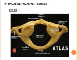 ATYPICAL CERVICAL VERTEBRAES :-
1. ATLAS :-
 