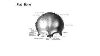 Flat Bone
 