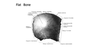 Flat Bone
 