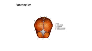 Fontanelles
 
