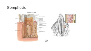 Gomphosis
 