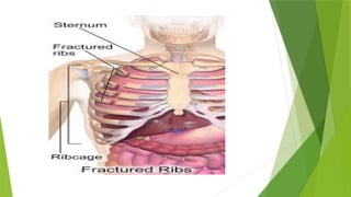 OSTEOLOGY OF RIBS for anatomy in b.d chaurasia | PPTX