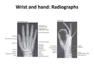 Wrist and hand: Radiographs
 