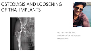 OSTEOLYSIS AND LOOSENING
OF THA IMPLANTS
PRESENTED BY- DR VASU
MODERATOR- DR ANURAG SIR
PIMS UDAIPUR
 