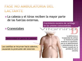  La cabeza y el tórax reciben la mayor parte
     de las fuerzas externas.
                                           Crecimiento excesivo de cartílago
                                           en las uniones costocondrales
    Craneotabes



    Deformidad en pecho de paloma


Las costillas se incurvan hacia adentro,
causando la protrusión del esternón
 