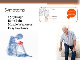 Symptoms
>50yrs age
Bone Pain
Muscle Weakness
Easy Fractures
 