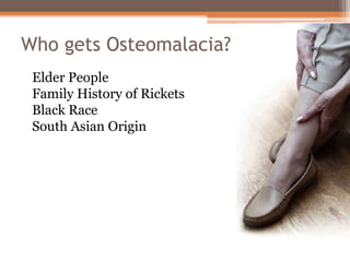 Who gets Osteomalacia?
Elder People
Family History of Rickets
Black Race
South Asian Origin
 