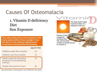 Causes Of Osteomalacia
1. Vitamin D deficiency
Diet
Sun Exposure
 