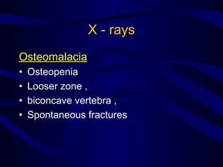X - rays
Osteomalacia
• Osteopenia
• Looser zone ,
• biconcave vertebra ,
• Spontaneous fractures
 