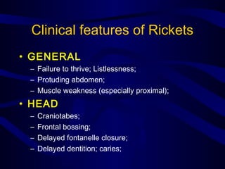 Clinical features of Rickets
• GENERAL
– Failure to thrive; Listlessness;
– Protuding abdomen;
– Muscle weakness (especially proximal);
• HEAD
– Craniotabes;
– Frontal bossing;
– Delayed fontanelle closure;
– Delayed dentition; caries;
 