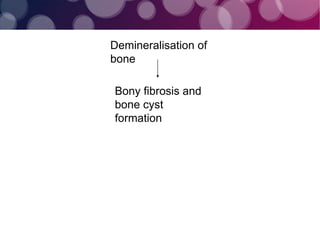 Demineralisation of
bone
Bony fibrosis and
bone cyst
formation
 