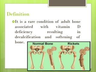 Definition
It is a rare condition of adult bone
associated with vitamin D
deficiency resulting in
decalcification and softening of
bone.