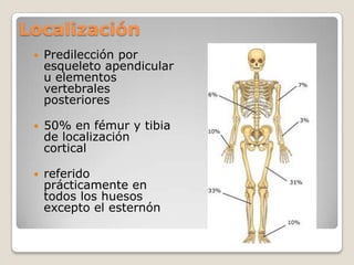 Localización


Predilección por
esqueleto apendicular
u elementos
vertebrales
posteriores



50% en fémur y tibia
de localización
cortical



referido
prácticamente en
todos los huesos
excepto el esternón

 