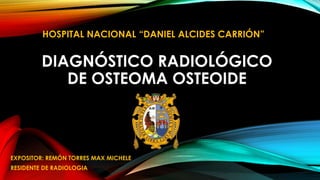 DIAGNÓSTICO RADIOLÓGICO
DE OSTEOMA OSTEOIDE
EXPOSITOR: REMÓN TORRES MAX MICHELE
RESIDENTE DE RADIOLOGIA
HOSPITAL NACIONAL “DANIEL ALCIDES CARRIÓN”
 