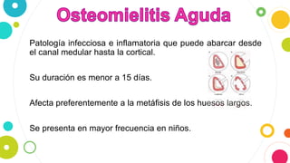 Patología infecciosa e inflamatoria que puede abarcar desde
el canal medular hasta la cortical.
Su duración es menor a 15 días.
Afecta preferentemente a la metáfisis de los huesos largos.
Se presenta en mayor frecuencia en niños.
 