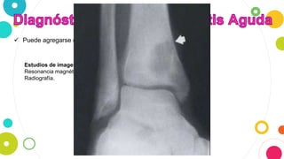  Puede agregarse estudios complementarios.
Estudios de imagen:
Resonancia magnética.
Radiografía.
 