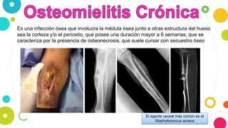 El agente causal más común es el
Staphylococcus aureus
Es una infección ósea que involucra la médula ósea junto a otras estructura del hueso
sea la corteza y/o el periostio, que posee una duración mayor a 6 semanas, que se
caracteriza por la presencia de osteonecrosis, que suele cursar con secuestro óseo
 
