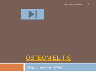 osteomielitis Diego Julián Hernández 1 diego julian hernandez 