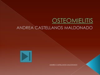 OSTEOMIELITIS ANDREA CASTELLANOS MALDONADO ANDREA CASTELLANOS MALDONADO 