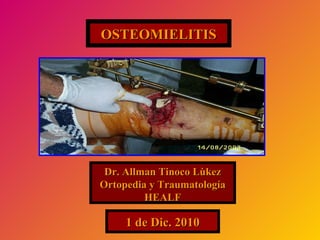 OSTEOMIELITIS 1 de Dic. 2010 Dr. Allman Tinoco L ù kez Ortopedia y Traumatología HEALF 