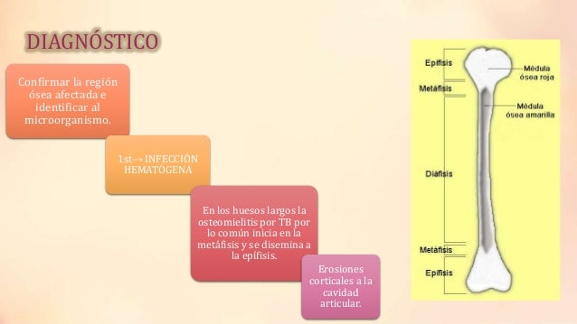 Los peligros del alcoholismo infantil