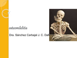 osteomilelitis
Dra. Sánchez Carbajal J. C. Dafne
 