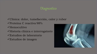 Osteomielitis.pptx