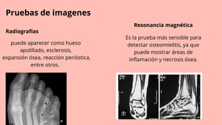 Pruebas de imagenes
Radiografías
Resonancia magnética
Es la prueba más sensible para
detectar osteomielitis, ya que
puede mostrar áreas de
inflamación y necrosis ósea.
puede aparecer como hueso
apolillado, esclerosis,
expansión ósea, reacción perióstica,
entre otros.
 