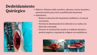 Objetivo: Eliminar tejido necrótico, abscesos, tractos sinusales y
material extraño para evitar la proliferación bacteriana.
Importancia:
Reduce la duración del tratamiento antibiótico y la tasa de
recurrencia.
Previene la diseminación de la infección si se realiza con
disección controlada.
Favorece la cicatrización cuando se combinan drenajes a
presión negativa y esponjas de colágeno con antibióticos.
Desbridamiento
Quirúrgico
 