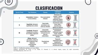 CLASIFICACION
 