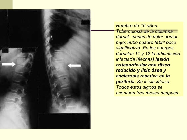 Spinalnoy las anestesias el dolor en la espalda