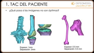 1. TAC DEL PACIENTE
• ¿Qué pasa si las imágenes no son óptimas?
Espesor: 1mm
Separación: 3mm
Espesor: 0.5 mm
Separación: 0.5 mm
 