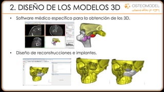 2. DISEÑO DE LOS MODELOS 3D
• Software médico específico para la obtención de los 3D.
• Diseño de reconstrucciones e implantes.
 