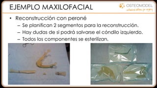 EJEMPLO MAXILOFACIAL
• Reconstrucción con peroné
– Se planifican 2 segmentos para la reconstrucción.
– Hay dudas de si podrá salvarse el cóndilo izquierdo.
– Todos los componentes se esterilizan.
 