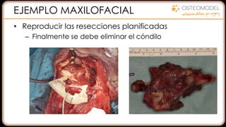 EJEMPLO MAXILOFACIAL
• Reproducir las resecciones planificadas
– Finalmente se debe eliminar el cóndilo
 