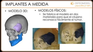 IMPLANTES A MEDIDA
• MODELO 3D: • MODELOS FÍSICOS:
• Se fabrica el modelo en dos
materiales para que el cirujano
reconozca fácilmente el tumor.
 