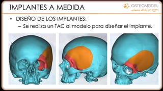 IMPLANTES A MEDIDA
• DISEÑO DE LOS IMPLANTES:
– Se realiza un TAC al modelo para diseñar el implante.
 