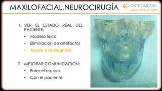1. VER EL ESTADO REAL DEL
PACIENTE:
• Modelo físico
• Eliminación de artefactos
• Ayuda a la diagnosis
2. MEJORAR COMUNICACIÓN:
• Entre el equipo
• Con el paciente
3. PLANIFICACIÓN QUIRÚRGICA
• Preformar de placas
• Seleccionar herramientas
• Prever complicaciones
DISMINUIR EL TIEMPO
REDUCIR RIESGOS
MEJORAR LA CALIDAD
MAXILOFACIAL,NEUROCIRUGÍA
 