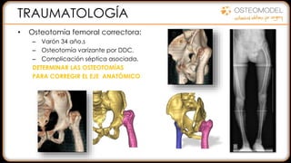 TRAUMATOLOGÍA
• Osteotomía femoral correctora:
– Varón 34 año.s
– Osteotomía varizante por DDC.
– Complicación séptica asociada.
DETERMINAR LAS OSTEOTOMÍAS
PARA CORREGIR EL EJE ANATÓMICO
 
