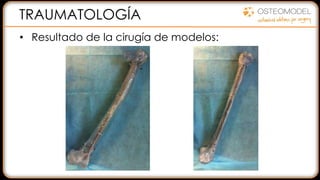 TRAUMATOLOGÍA
• Resultado de la cirugía de modelos:
 