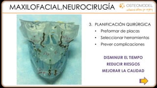 1. VER EL ESTADO REAL DEL
PACIENTE:
• Modelo físico
• Eliminación de artefactos
• Ayuda a la diagnosis
2. MEJORAR COMUNICACIÓN:
• Entre el equipo
• Con el paciente
3. PLANIFICACIÓN QUIRÚRGICA
• Preformar de placas
• Seleccionar herramientas
• Prever complicaciones
DISMINUIR EL TIEMPO
REDUCIR RIESGOS
MEJORAR LA CALIDAD
MAXILOFACIAL,NEUROCIRUGÍA
 