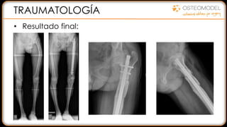 TRAUMATOLOGÍA
• Resultado final:
 