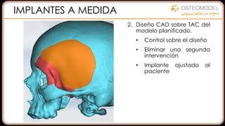 2. Diseño CAD sobre TAC del
modelo planificado.
• Control sobre el diseño
• Eliminar una segunda
intervención
• Implante ajustado al
paciente
1. ALCANCE DEL DEFECTO:
• Ayuda a la diagnosis
• Comunicación paciente
• Comunicación con el
equipo
2. PLANIFICACIÓN
QUIRÚRGICA:
• Resección, Abordaje
• Selección de las placas y
tornillos
Como los modelos son
radiopacos…
IMPLANTES A MEDIDA
 