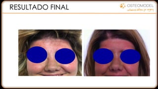 RESULTADO FINAL
 