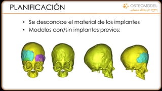 PLANIFICACIÓN
• Se desconoce el material de los implantes
• Modelos con/sin implantes previos:
 