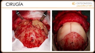 CIRUGÍA
 