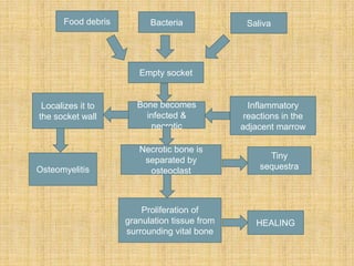 Food debris Bacteria Saliva
Empty socket
Bone becomes
infected &
necrotic
Inflammatory
reactions in the
adjacent marrow
Localizes it to
the socket wall
Osteomyelitis
Necrotic bone is
separated by
osteoclast
Tiny
sequestra
Proliferation of
granulation tissue from
surrounding vital bone
HEALING
 